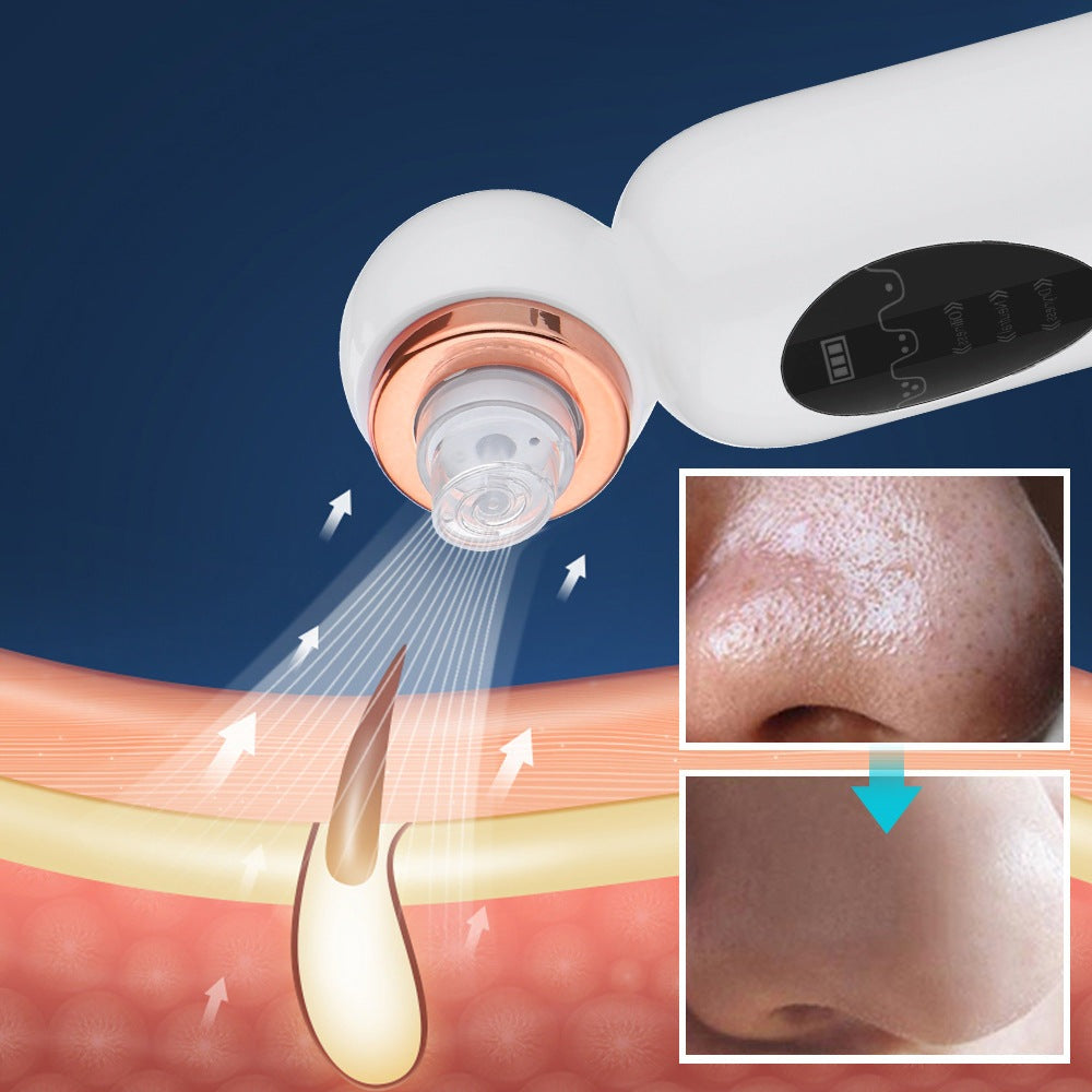 Mee-eter verwijderaar en hydrodermabrasie — afbeelding 3