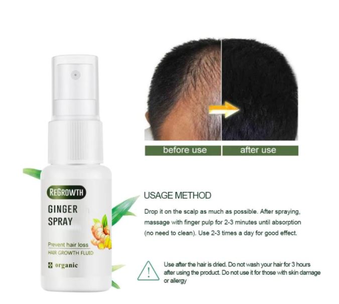 Hair regrowth ginger spray️