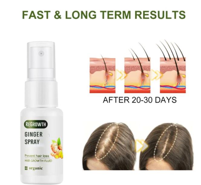 Hair regrowth ginger spray️