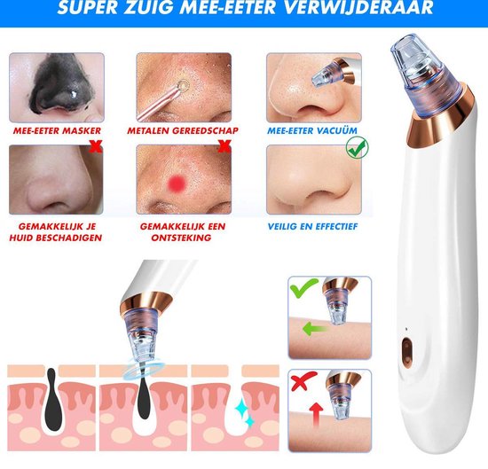 Poriënreiniger ClearFace
