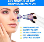 Poriënreiniger ClearFace