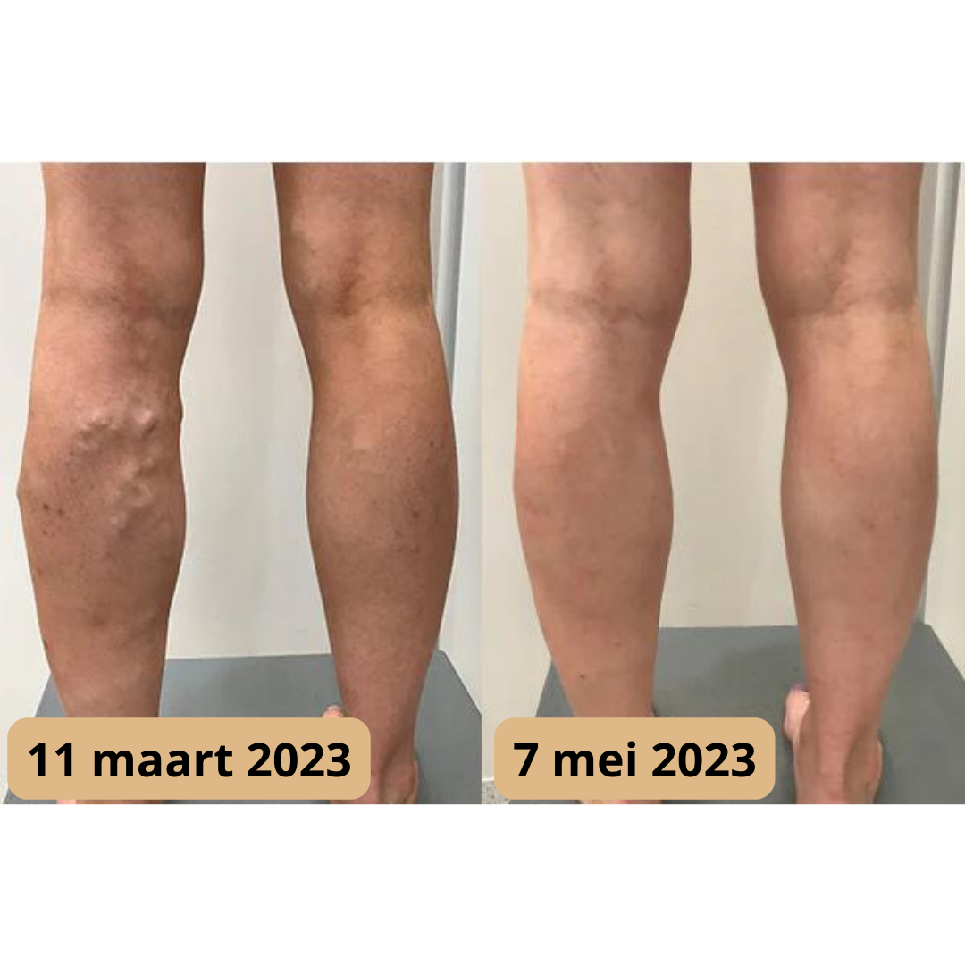 Voetmassage mat