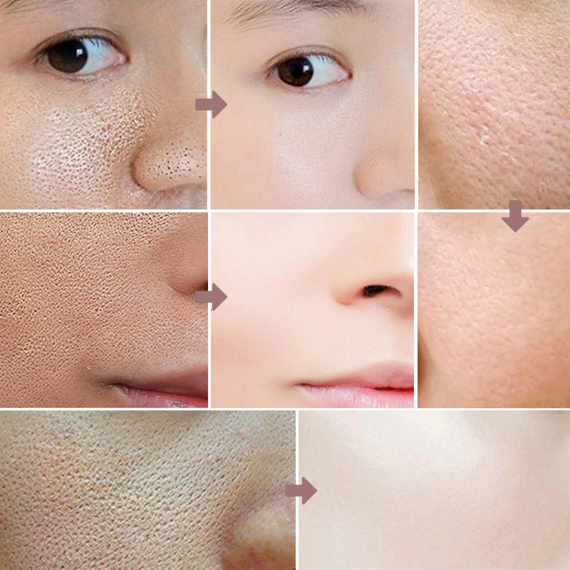 Lanbena pores serum