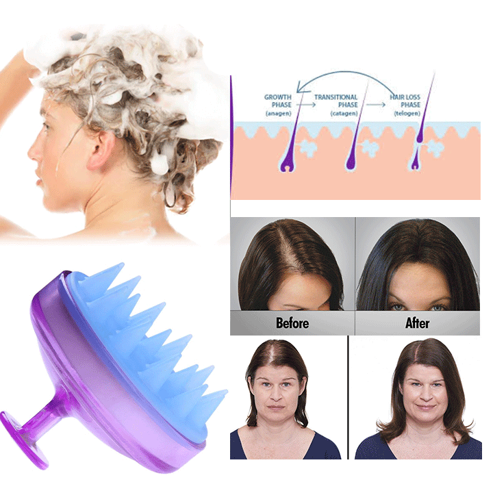 Hoofdhuid massage borstel – scalp voor de hoofdhuid