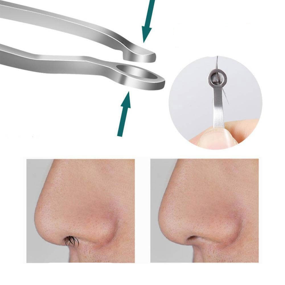 Ontharing pincet Ear nose trimmer — afbeelding 8