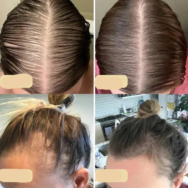 Natuurlijke haargroei olie
