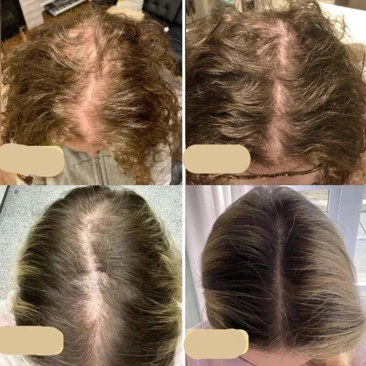 Natuurlijke haargroei olie